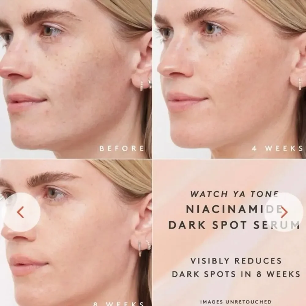 Fenty Skin's Watch Ya Tone Niacinamide‎ Dark Spot Treatment vegan Serum 30ml